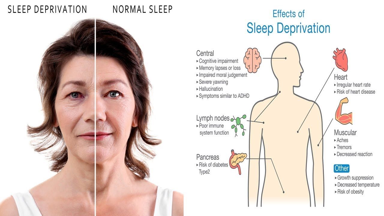 Top Effects of Sleep Deprivation on Your Body